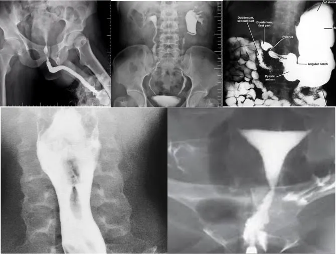 Radiology Process